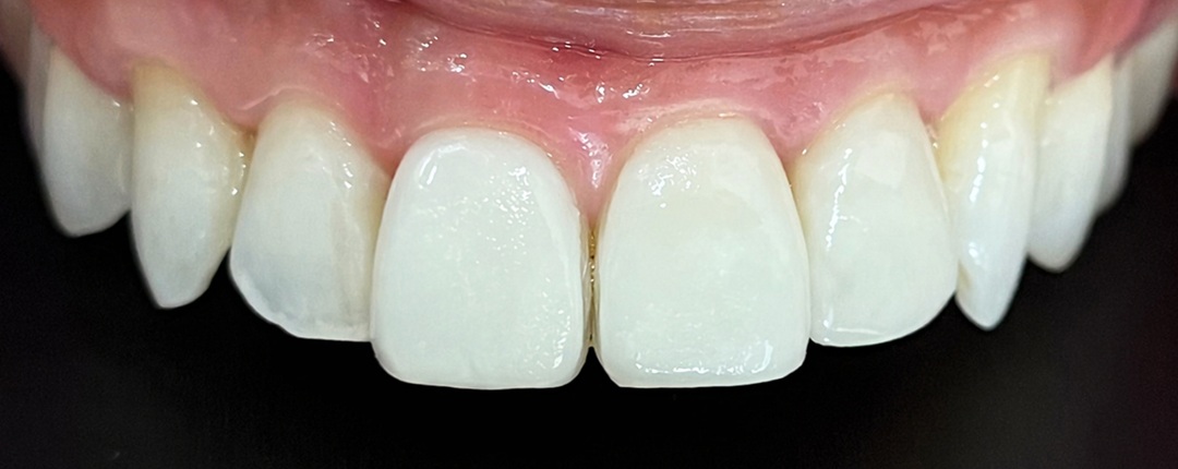 CASE.02 after