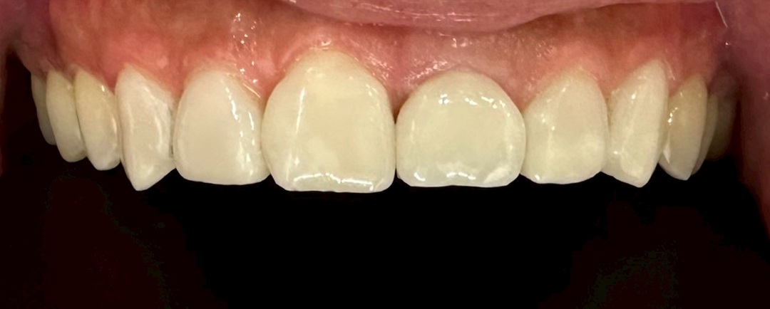 CASE.03 after